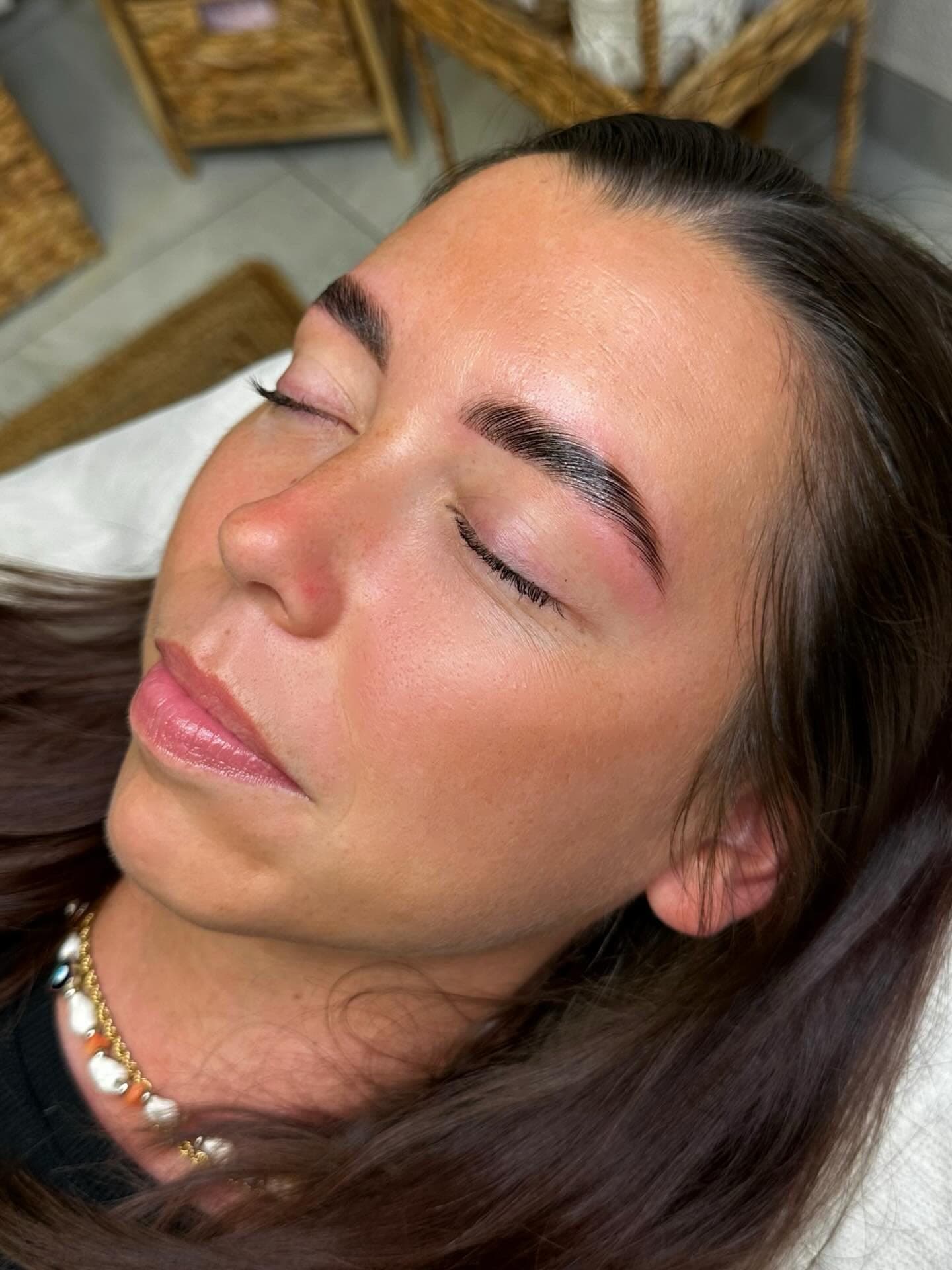 Browlifting Ergebnis
